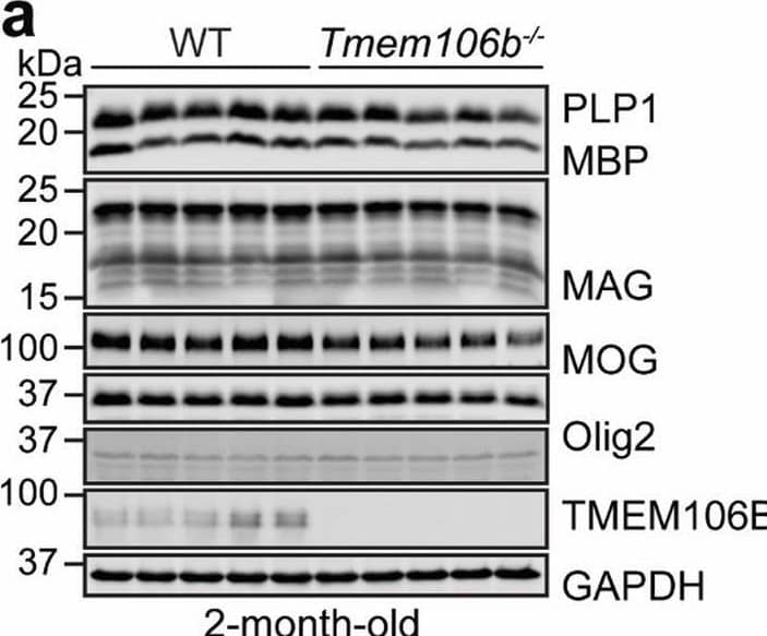Detection of Olig2 by Western Blot