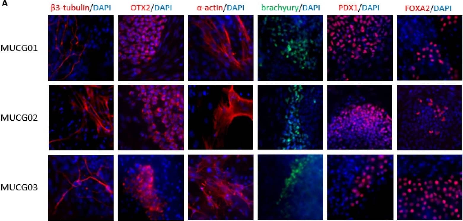 Detection of Human PDX-1/IPF1 by Immunocytochemistry/ Immunofluorescence