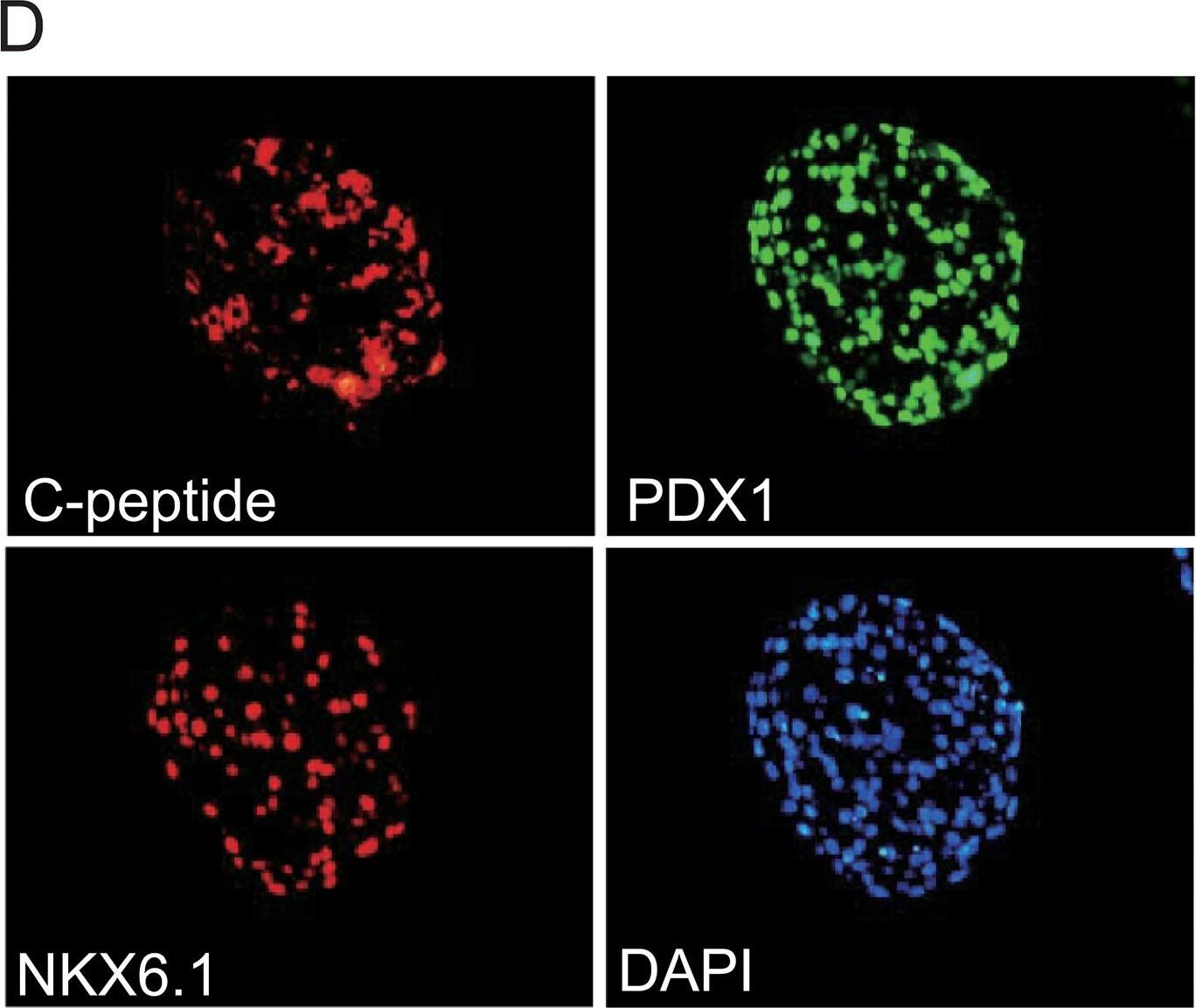 Detection of Human PDX-1/IPF1 by Immunocytochemistry/Immunofluorescence