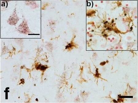 Detection of Human Progranulin/PGRN by Immunohistochemistry