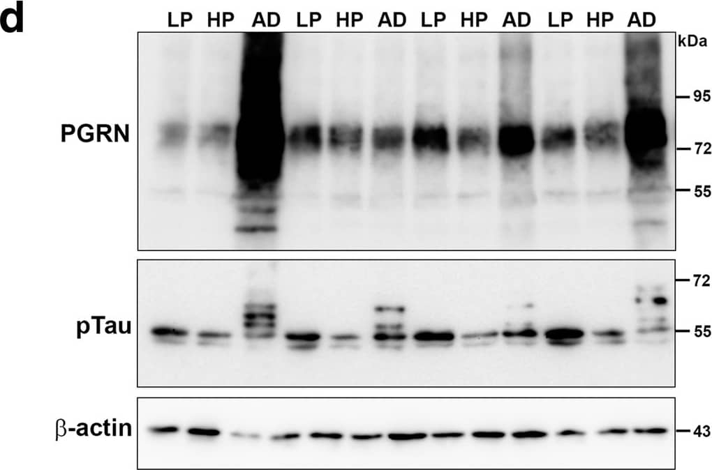 Detection of Human Progranulin/PGRN by Western Blot