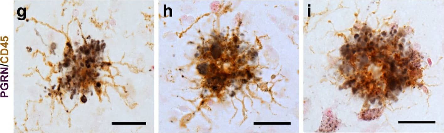 Detection of Human Progranulin/PGRN by Immunohistochemistry