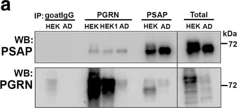 Detection of Human Progranulin/PGRN by Western Blot