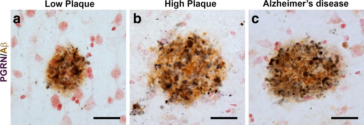 Detection of Human Progranulin/PGRN by Immunohistochemistry