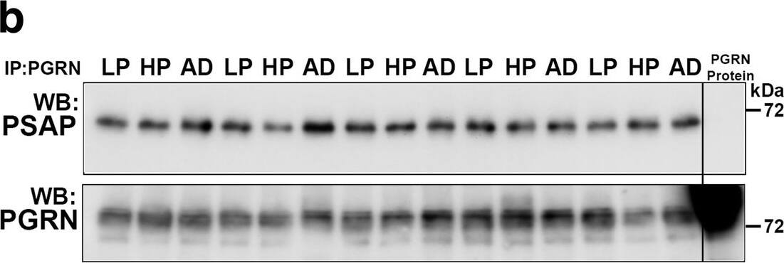 Detection of Human Progranulin/PGRN by Western Blot