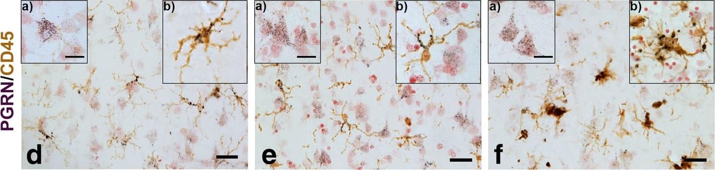 Detection of Human Progranulin/PGRN by Immunohistochemistry