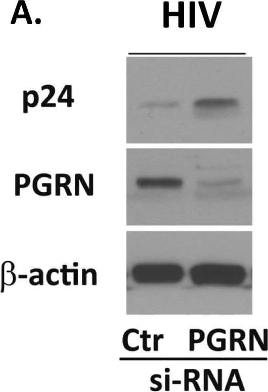 Detection of Human Progranulin/PGRN by Western Blot