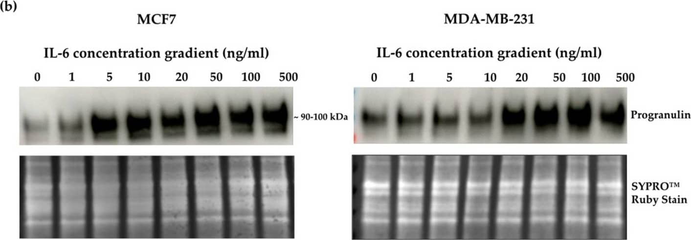 Detection of Progranulin/PGRN by Western Blot