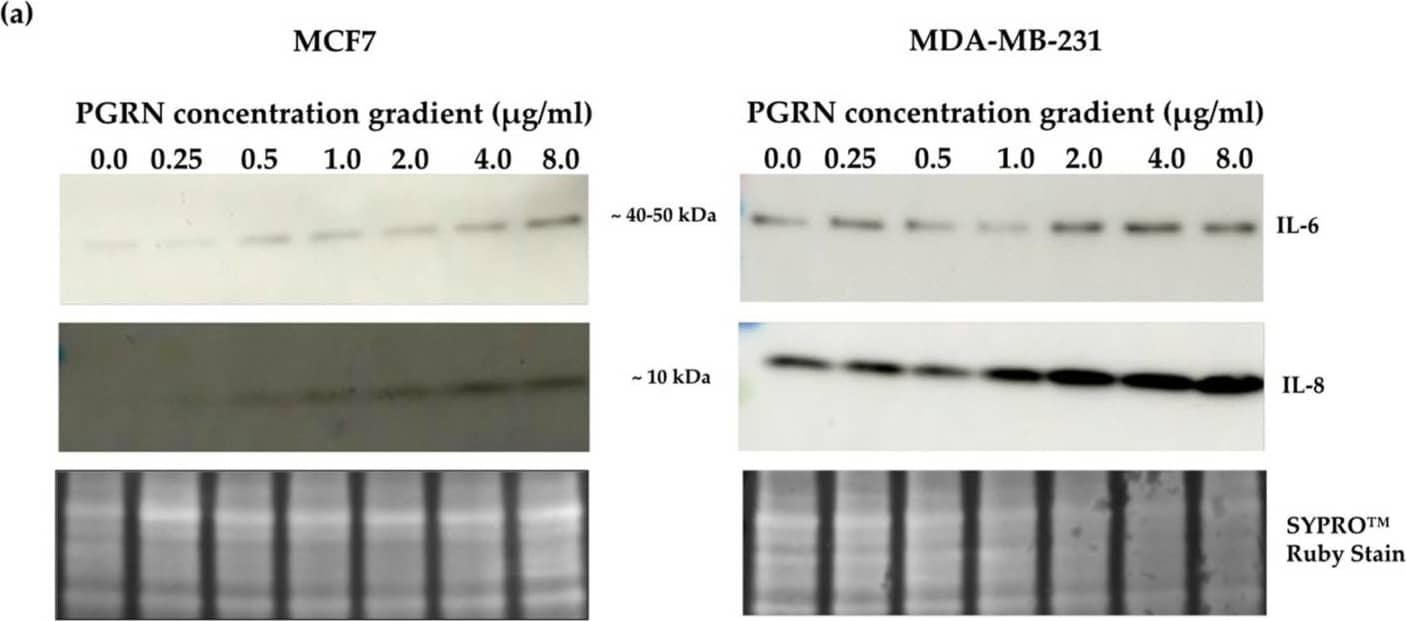 Detection of Progranulin/PGRN by Western Blot