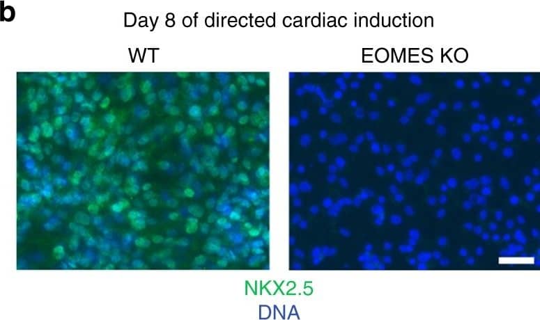 Detection of Human NKX2.5 by Immunocytochemistry/Immunofluorescence