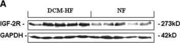 Detection of IGF-II R/IGF2R by Western Blot
