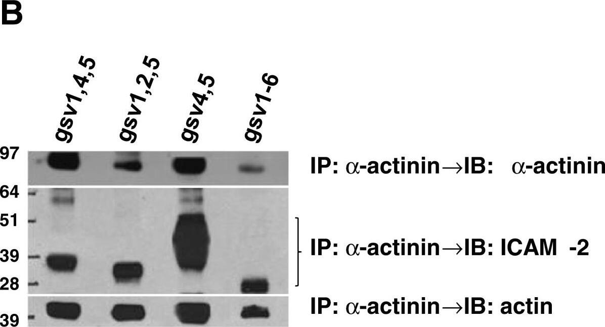 Detection of Human ICAM-2/CD102 by Western Blot