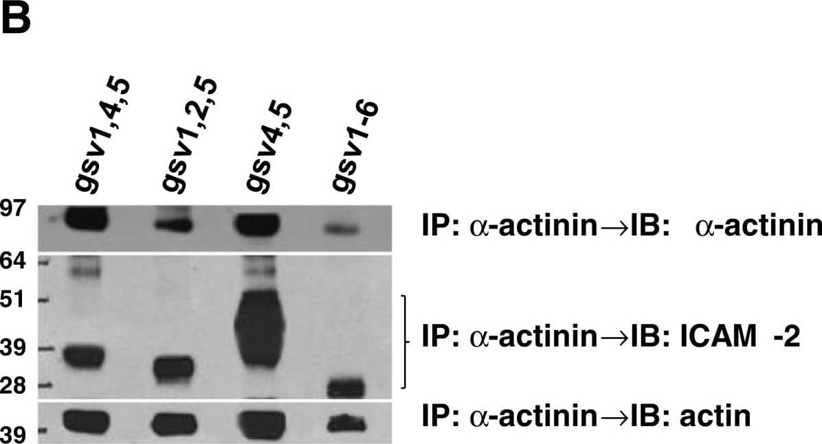 Detection of Human ICAM-2/CD102 by Western Blot