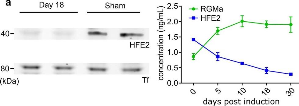 Detection of RGM-A by Western Blot