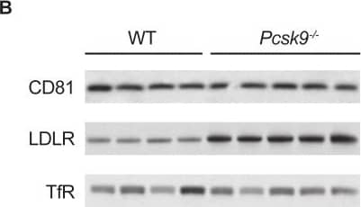 Detection of Mouse TfR (Transferrin R) by Western Blot