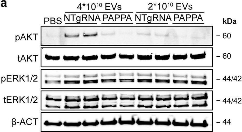 Detection of Pappalysin-1/PAPP-A by Western Blot