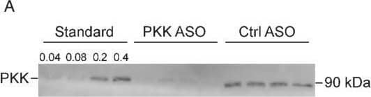 Detection of Plasma Kallikrein/KLKB1 by Western Blot