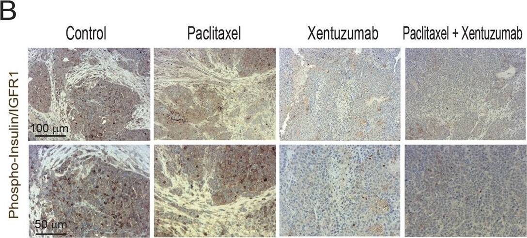 Detection of Human Human Phospho-Insulin R (Y1162/Y1163)/ IGF-I R (Y1135/Y1136) Antibody by Immunohistochemistry