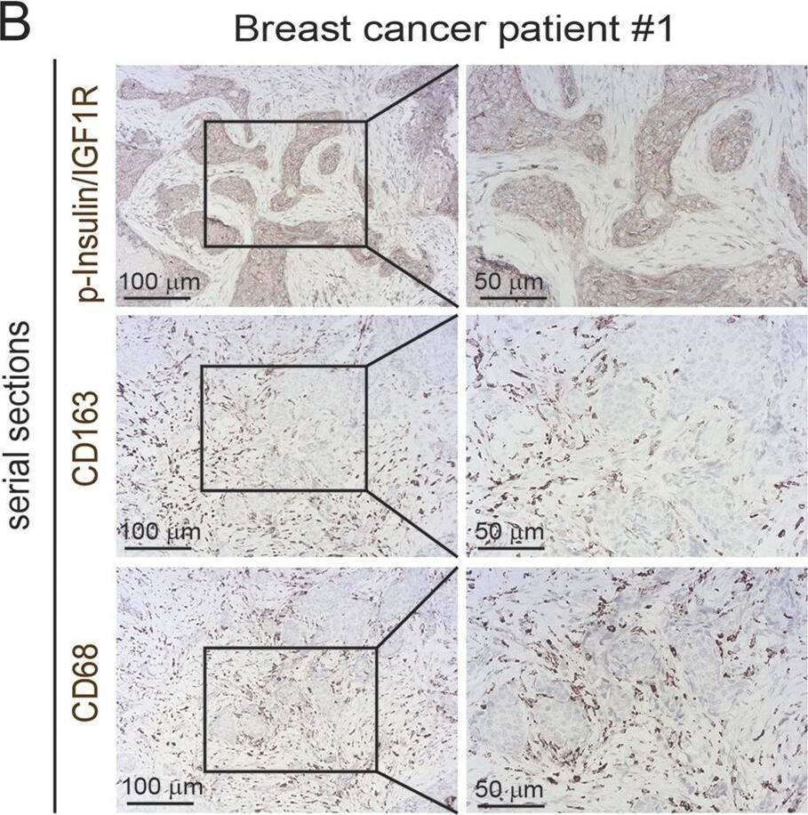 Detection of Human Human Phospho-Insulin R (Y1162/Y1163)/ IGF-I R (Y1135/Y1136) Antibody by Immunohistochemistry