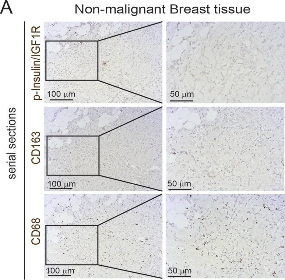 Detection of Human Human Phospho-Insulin R (Y1162/Y1163)/ IGF-I R (Y1135/Y1136) Antibody by Immunohistochemistry