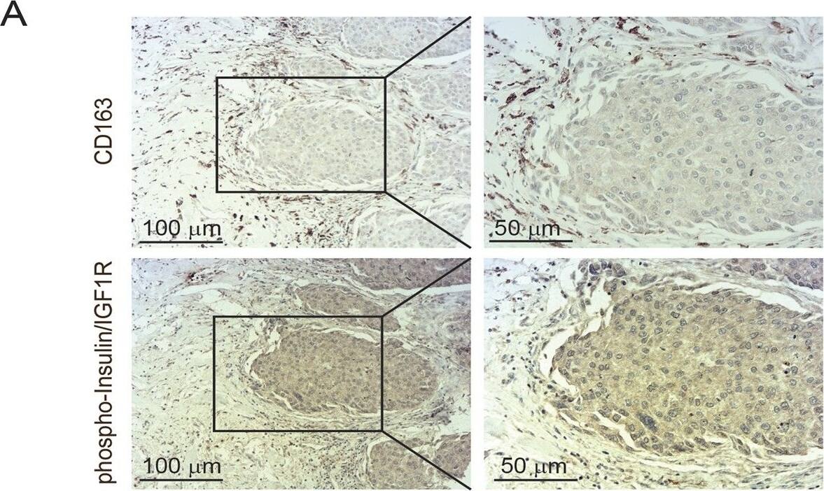 Detection of Human Human Phospho-Insulin R (Y1162/Y1163)/ IGF-I R (Y1135/Y1136) Antibody by Immunohistochemistry