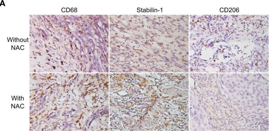 Detection of MMR/CD206 by Immunohistochemistry