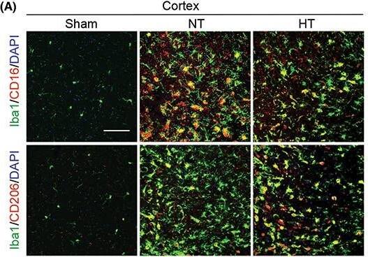 Detection of Mouse MMR/CD206/Mannose Receptor by Immunohistochemistry