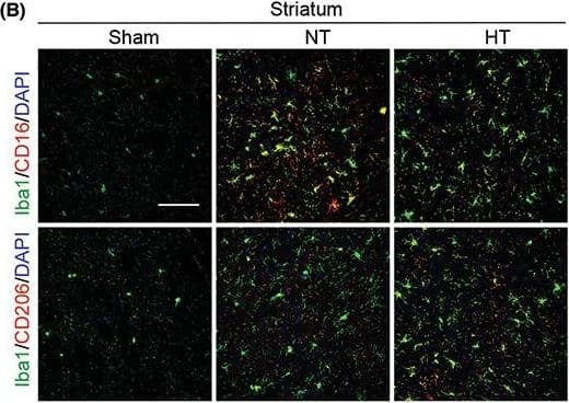 Detection of Mouse MMR/CD206/Mannose Receptor by Immunohistochemistry