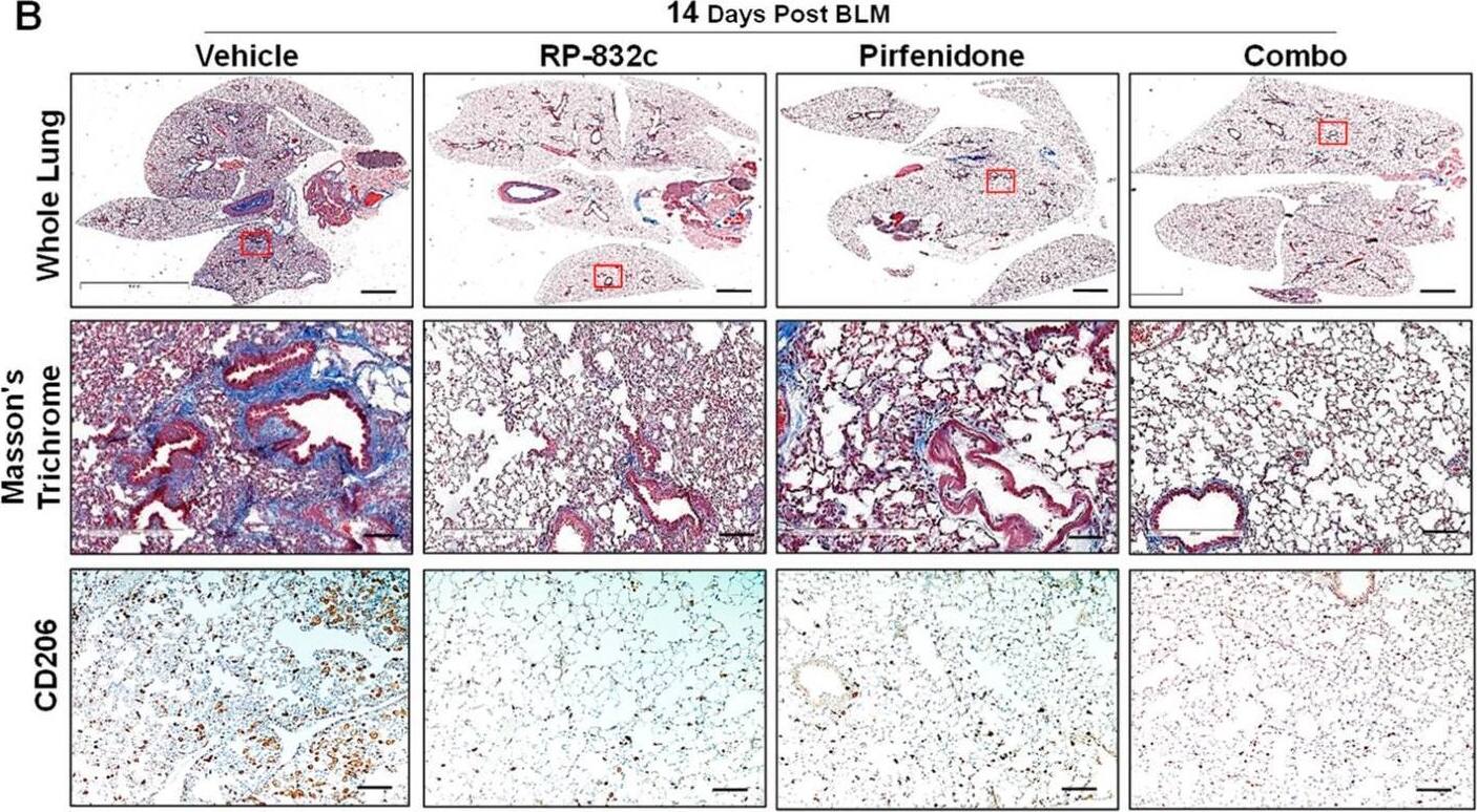 Detection of MMR/CD206 by Immunohistochemistry