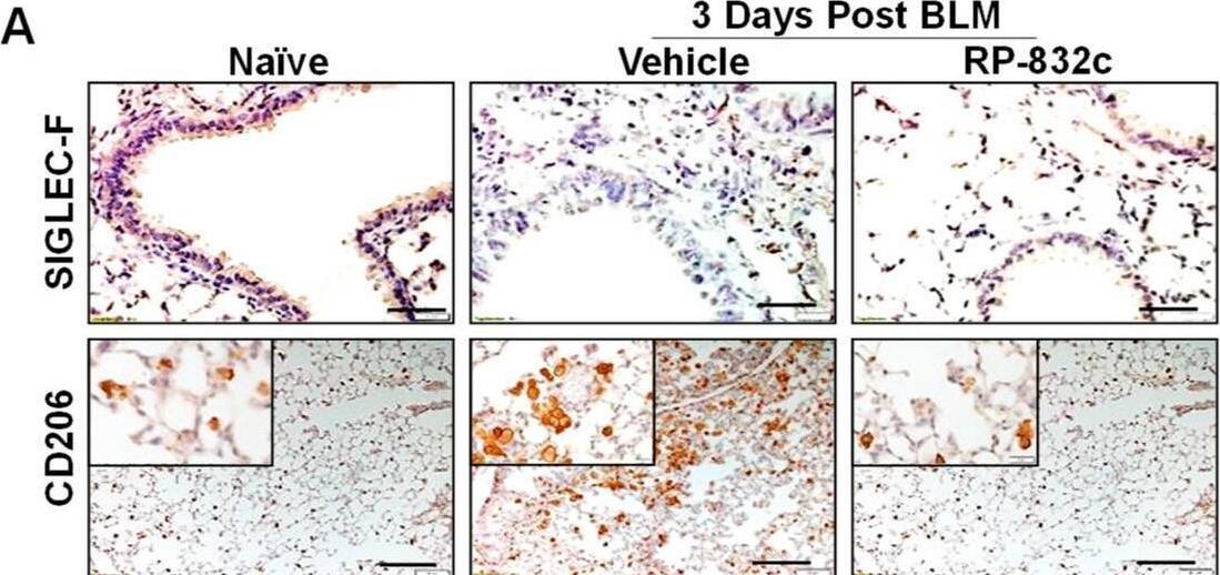 Detection of MMR/CD206 by Immunohistochemistry