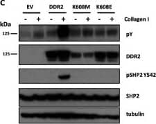 Detection of Human Human DDR2 Antibody by Western Blot