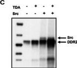 Detection of Human Human DDR2 Antibody by Western Blot