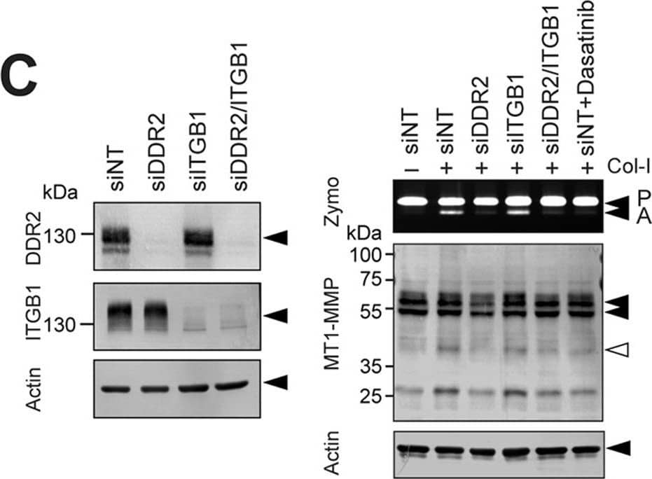 Detection of Human DDR2 by Western Blot