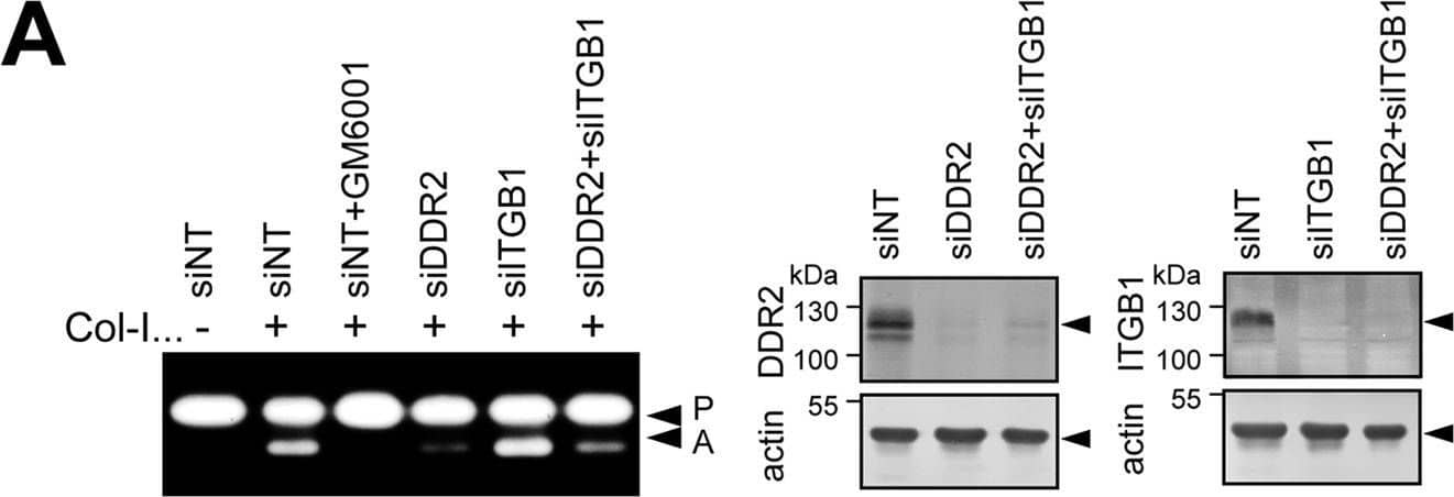 Detection of Human DDR2 by Knockdown Validated