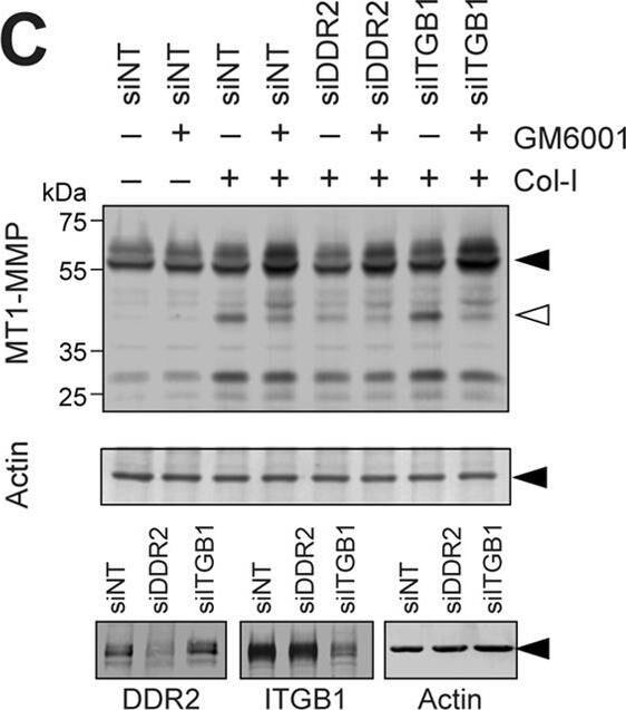 Detection of Human DDR2 by Knockdown Validated