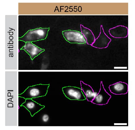 Osteoactivin/GPNMB Specificity is Shown by Immunocytochemistry in Knockdown Cell Line.