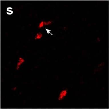Detection of Human Osteoactivin/GPNMB by Immunohistochemistry