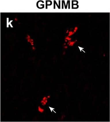 Detection of Human Osteoactivin/GPNMB by Immunohistochemistry