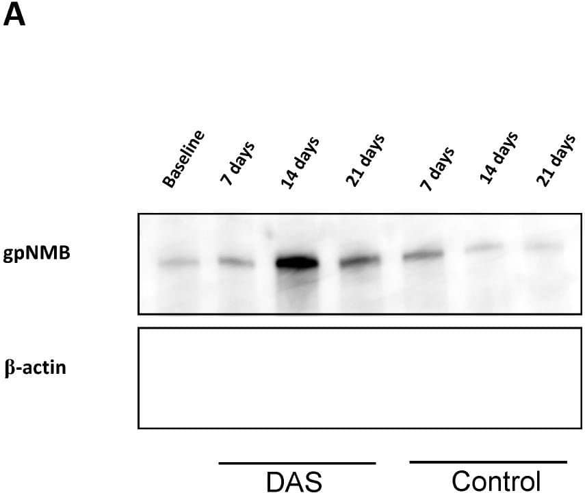 Detection of Osteoactivin/GPNMB by Western Blot