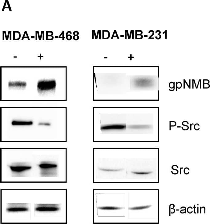 Detection of Osteoactivin/GPNMB by Western Blot