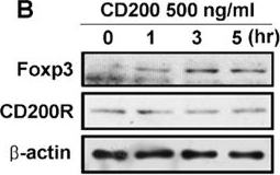 Detection of CD200R1 by Western Blot