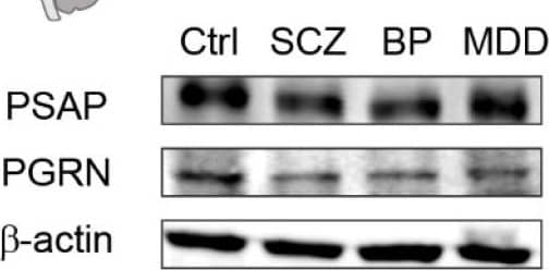 Detection of Human Mouse Progranulin/PGRN Antibody by Western Blot