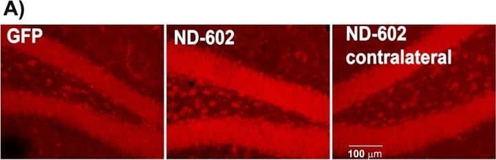 Detection of Mouse Progranulin/PGRN by Immunocytochemistry/Immunofluorescence