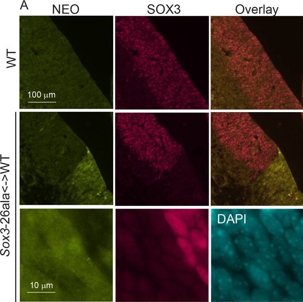 Detection of SOX3 by Immunohistochemistry