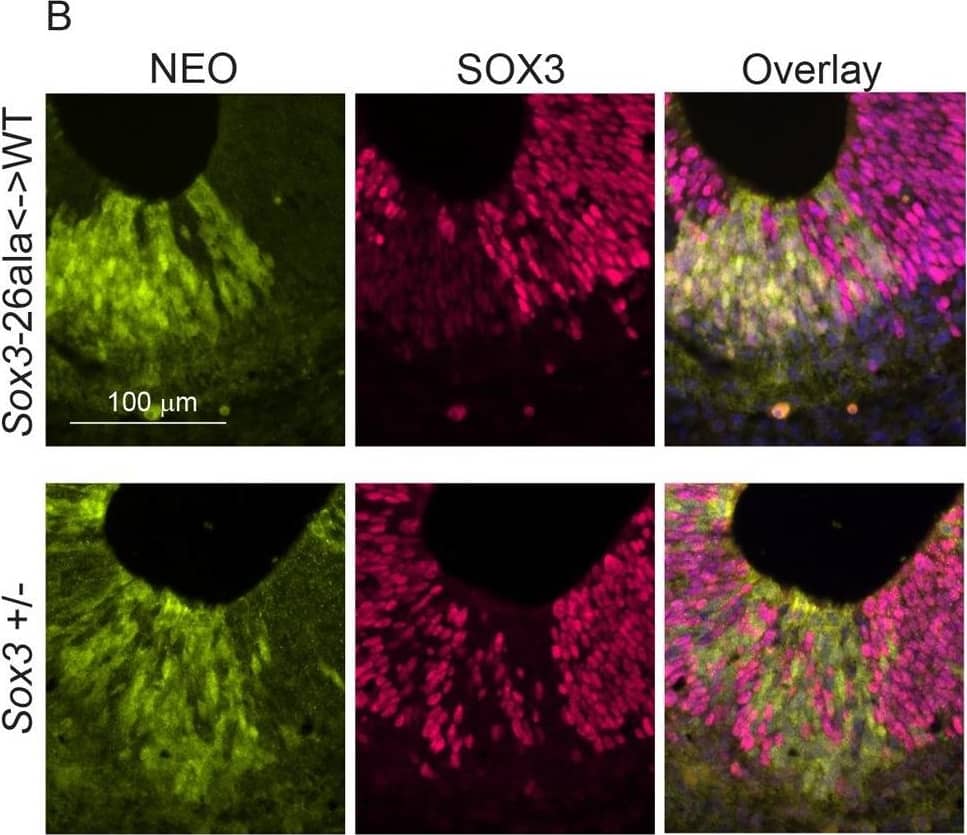 Detection of SOX3 by Immunohistochemistry