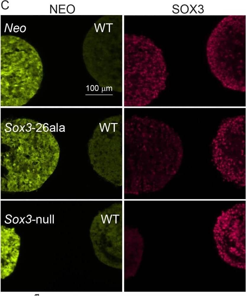 Detection of SOX3 by Immunocytochemistry/ Immunofluorescence