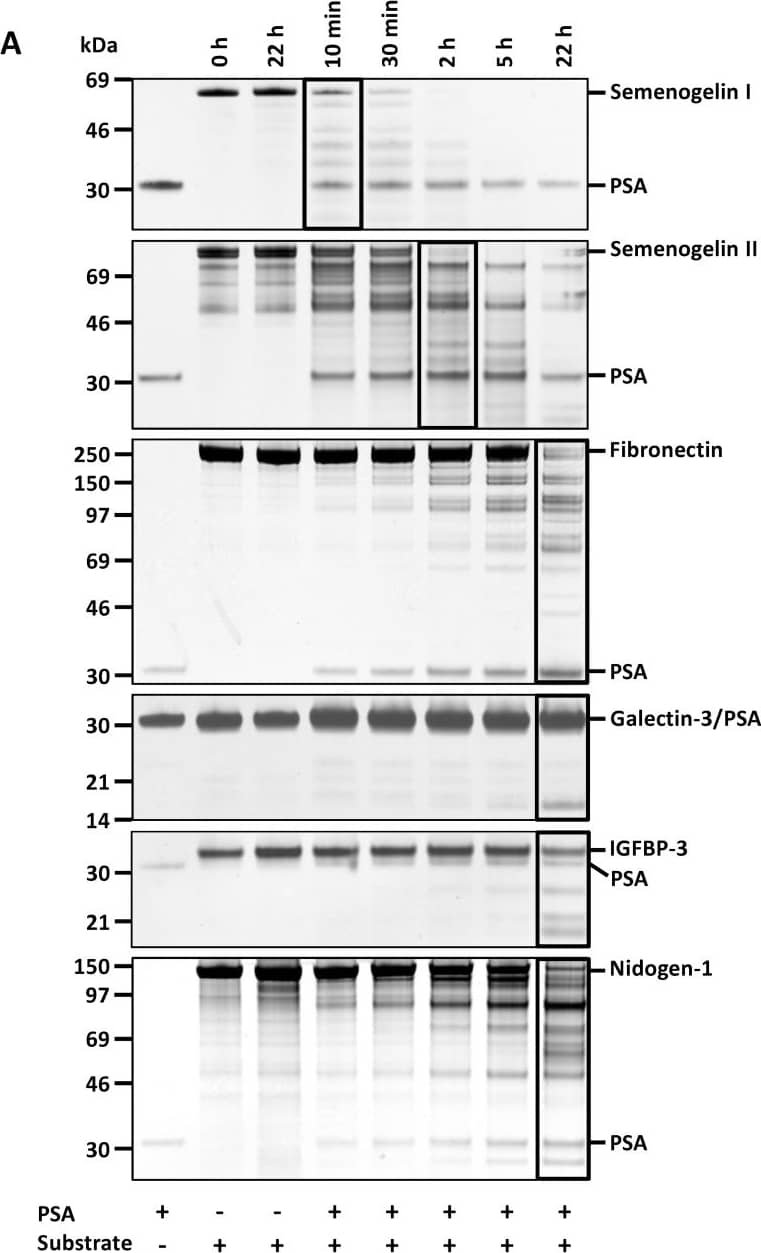 Detection of Human Nidogen-1/Entactin by Western Blot
