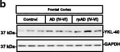 Detection of Human Chitinase 3-like 1 by Western Blot