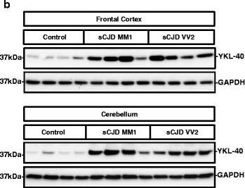 Detection of Human Chitinase 3-like 1 by Western Blot