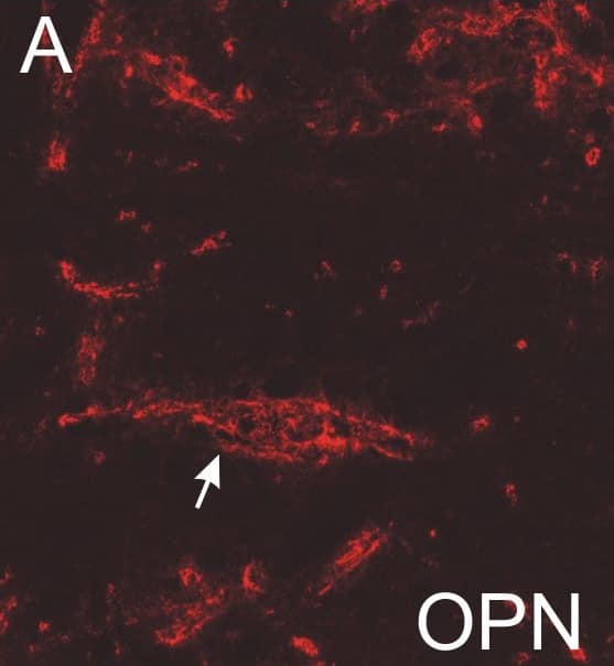 Detection of Human HAPLN1 by Immunocytochemistry/Immunofluorescence